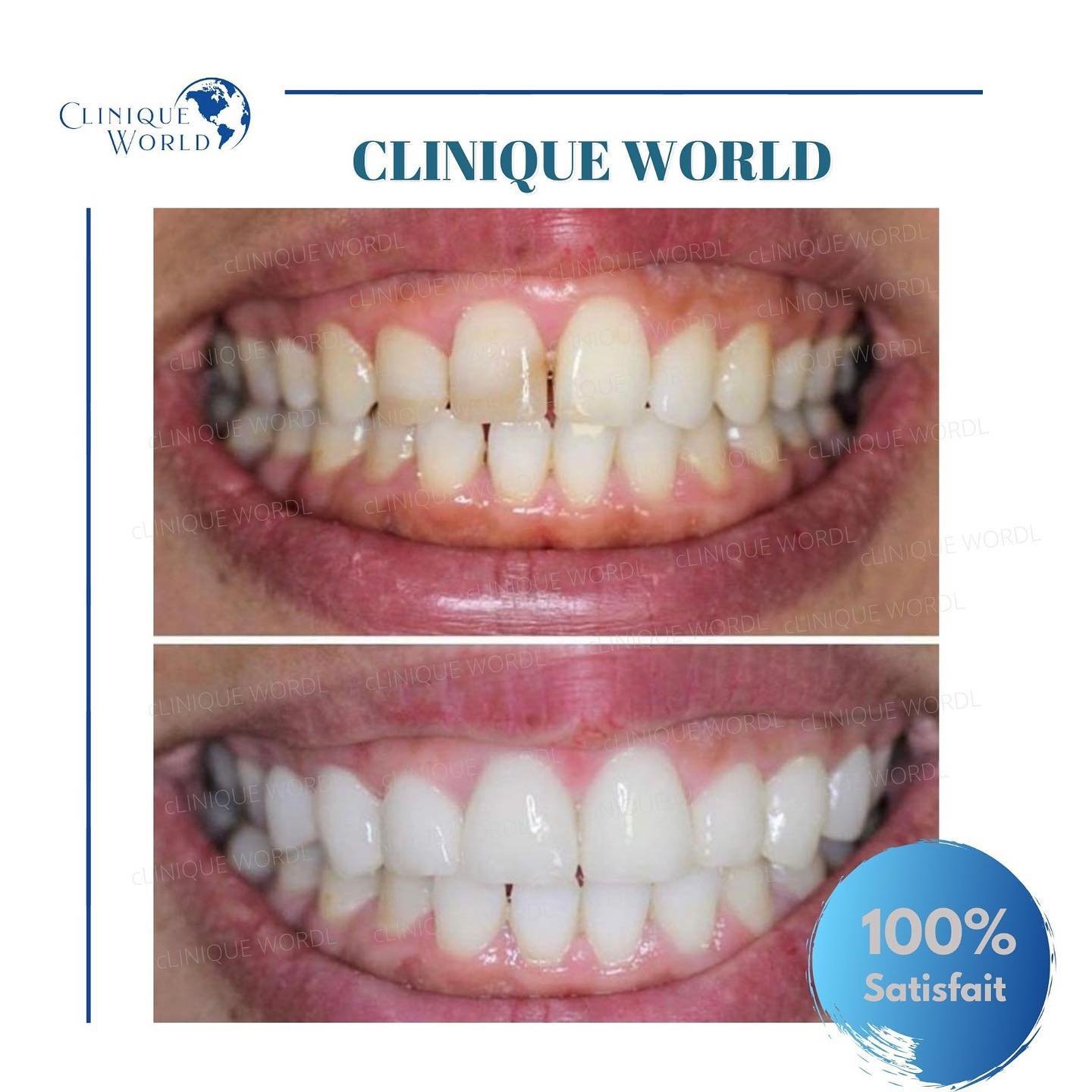 Clinique World dental photograph illustrating a smile; the material is not identified