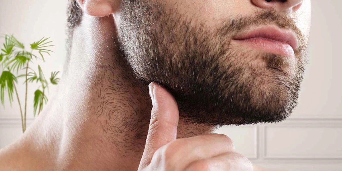 Illustrative treatment photograph; no treatment outcome is shown